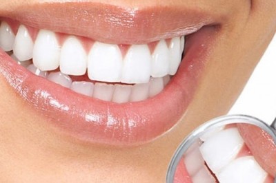 Dişlerinizdeki Sarılıktan Nasıl Kurtulabilirsiniz?